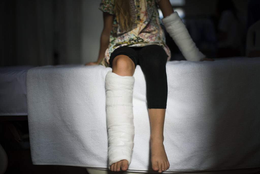Young girl sitting on a hospital bed with both legs in plaster casts, symbolizing the impact of serious workplace injuries and the need for vocational rehabilitation benefits.